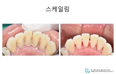 웰치과의원 성남