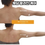 마인힐에스테틱 안양범계점