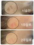 미라클뷰티랩 마곡본점