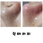 쉼테라피