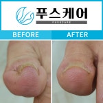 푸스케어 청량리역점