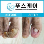 푸스케어 청량리역점