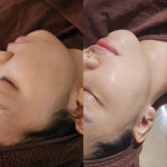 율 에스테틱 선릉점