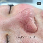 퍼스널뷰티 인 왁싱(in waxing) | 퍼스널뷰티 인 왁싱