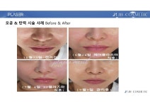 이아소에스떼