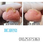 #손톱에 물들다 화원 | 샵 손톱에 물들다&페디클린업 내성발톱.무좀발톱.발각질