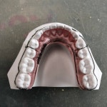 하이테크화이트치과기공소