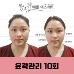 예플에스테틱 수원광교점