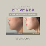 삼성비앤에스의원 강남