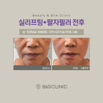 삼성비앤에스의원 강남