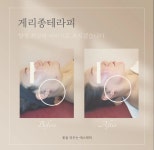 단미브로우