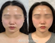 예라인에스테틱 광주본점