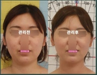 라라에스떼/ 얼굴축소연구소
