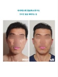 라라에스떼/ 얼굴축소연구소