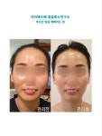 라라에스떼/ 얼굴축소연구소