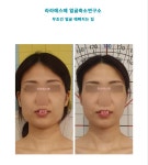 라라에스떼/ 얼굴축소연구소