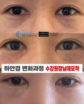 콜드플라즈마지사 아미뷰티 아카데미