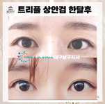 콜드플라즈마지사 아미뷰티 아카데미
