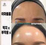 콜드플라즈마지사 아미뷰티 아카데미