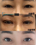 콜드플라즈마지사 아미뷰티 아카데미
