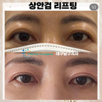 콜드플라즈마지사 아미뷰티 아카데미