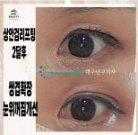 콜드플라즈마지사 아미뷰티 아카데미