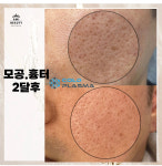 콜드플라즈마지사 아미뷰티 아카데미