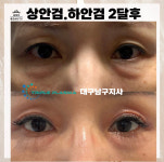 콜드플라즈마지사 아미뷰티 아카데미