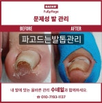수네일