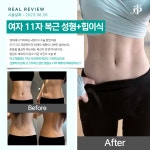 엔비성형외과의원 강남