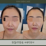 부천중동 란스킨케어