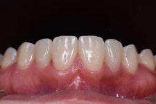 동그라미치과기공소