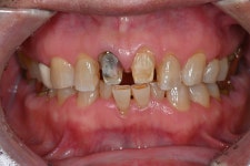 동그라미치과기공소