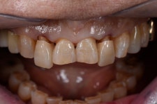 동그라미치과기공소