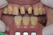 동그라미치과기공소