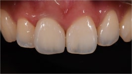 동그라미치과기공소