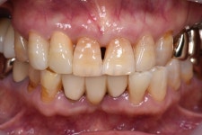 동그라미치과기공소