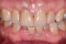 동그라미치과기공소