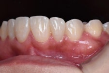 동그라미치과기공소