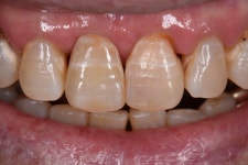 동그라미치과기공소