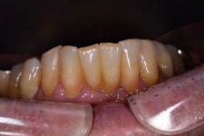 동그라미치과기공소