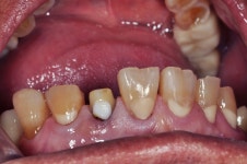 동그라미치과기공소