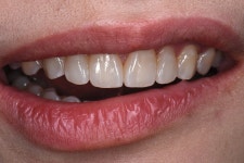 동그라미치과기공소