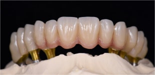 동그라미치과기공소