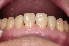 동그라미치과기공소