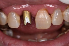 동그라미치과기공소