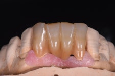 동그라미치과기공소