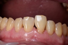 동그라미치과기공소