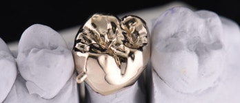 동그라미치과기공소