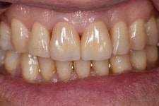 동그라미치과기공소